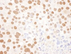 ILF2 Antibody, Novus Biologicals 0.1mg; Unlabeled:Antibodies, Polyclonal